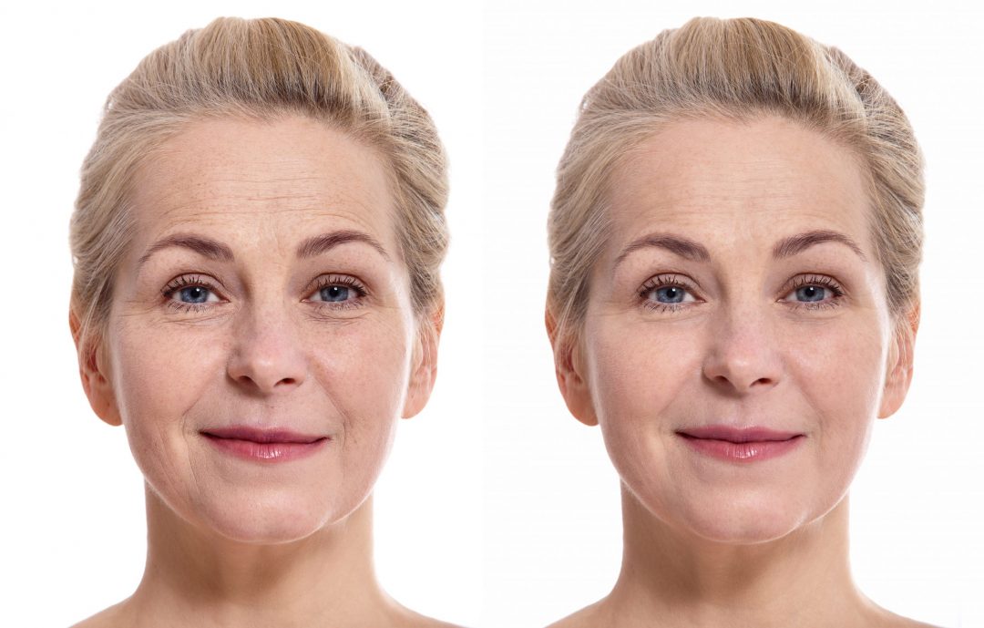 prevent skin aging
